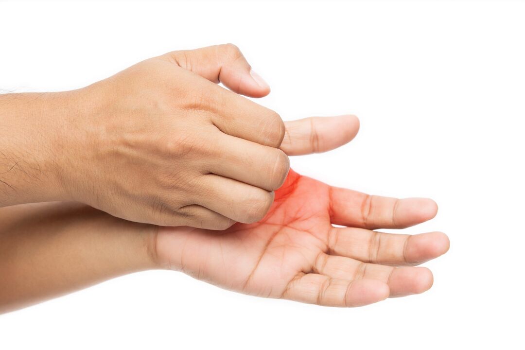 Svrbenie hubami a jej ošetrenie demyxilovým krémom